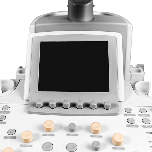 Philips iU22 F Cart Ultrasound 5